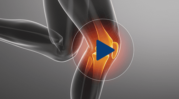 MCL Repair London - Consultant Orthopaedic Knee Surgeon